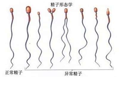 精子畸形率高是什么导致的
