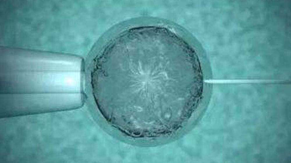 泰国第三代试管婴儿