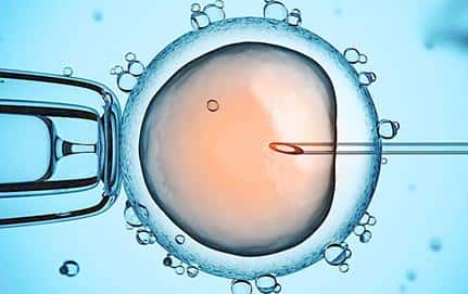 试管婴儿技术探索