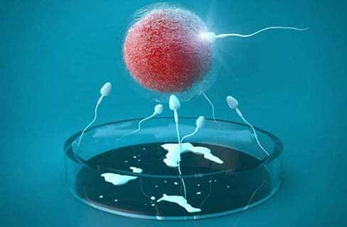 第三代试管婴儿技术