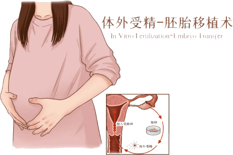 胚胎移植技术
