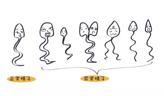 有哪些表现可以判定为精子质量差？