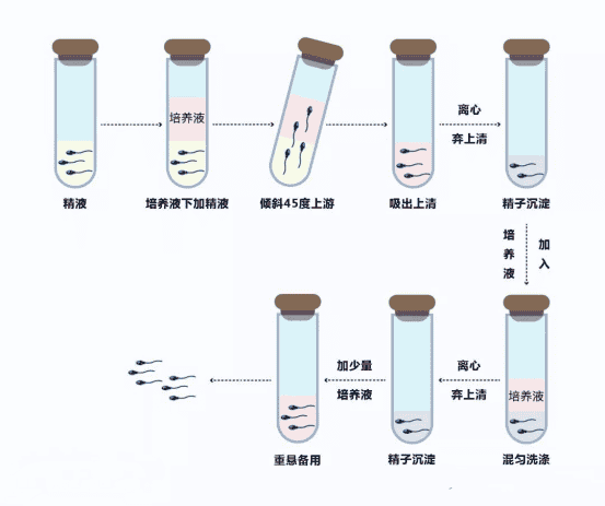 HIV患者做泰国三代试管婴儿的流程
