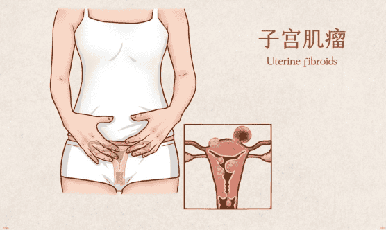 在做试管婴儿之前，患者都会去做全方位的身体检查