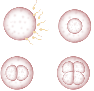 精子质量-泰国试管婴儿帕雅泰3